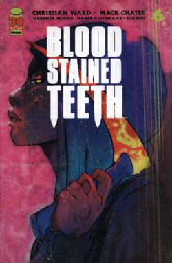 Blood Stained Teeth [Image] (2022) 6