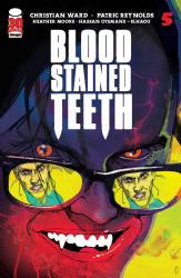 Blood Stained Teeth [Image] (2022) 5